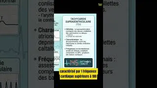 Miniature : TSV Cardiologie: C'est Quoi? Tachycardie Supraventriculaire Symptômes, Causes, Traitement 2026