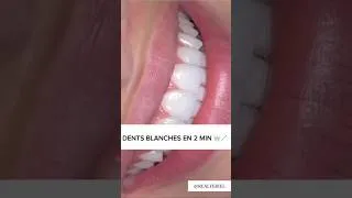 Miniature : BLANCHIR SES DENTS EN 2 MINUTES 🤩🦷 #astucesbeauté  #diy  #astuce #whiteningteeth #blanchiment