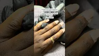 Miniature : blessure pere  et blessure mere