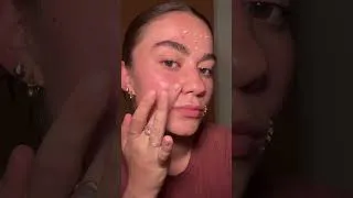 Miniature : J’ai effacé les ridules de ma bouche !!!!
