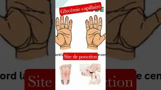 Miniature : #soinsinfirmiers #glycemie #étudiantinfirmier #apprends