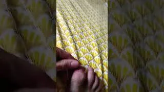Miniature : mon ongle va bientôt tomber