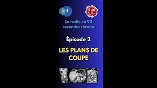 Miniature : [La radio en 90 sec chrono] - Épisode 2 : LES PLANS DE COUPE