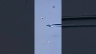 Miniature : Elle aspire un spermatozoïde pour l’injecter dans un ovule ! #pma