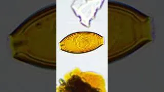 Miniature : 7 œuvres finalistes de l'Université Laval aux concours La preuve par l'image et Science Exposed