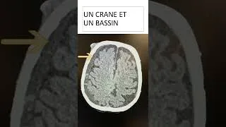 Miniature : UCA - Chute - un crane et un bassin